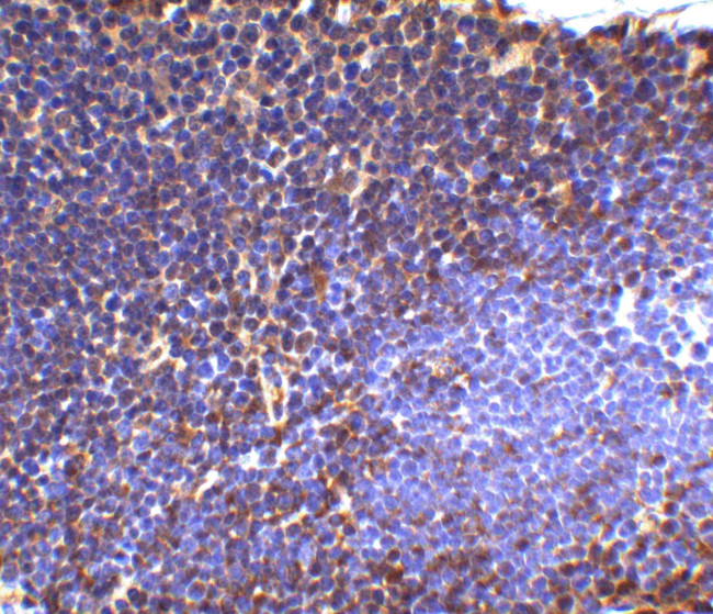 UBC13 Antibody in Immunohistochemistry (IHC)