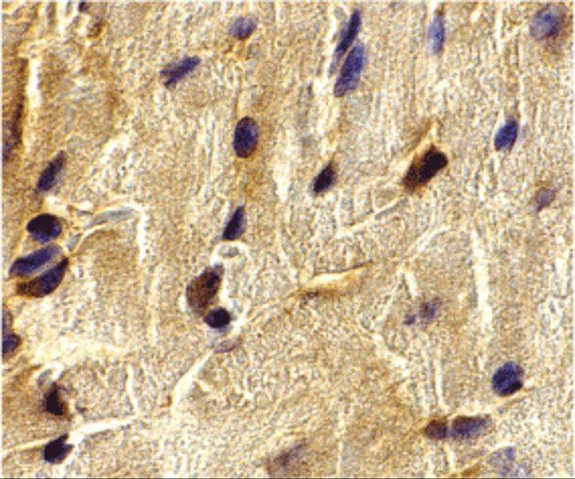 ECSIT Antibody in Immunohistochemistry (IHC)