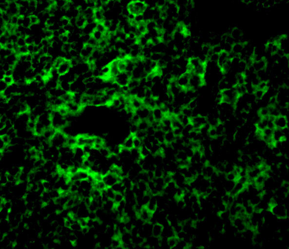 TAK1 Antibody in Immunocytochemistry (ICC/IF)