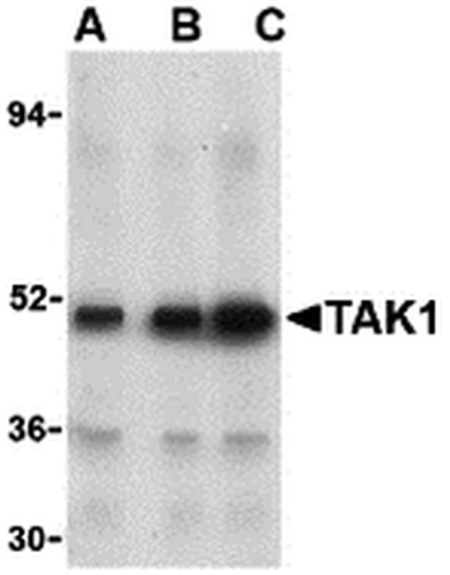 TAK1 Antibody in Western Blot (WB)