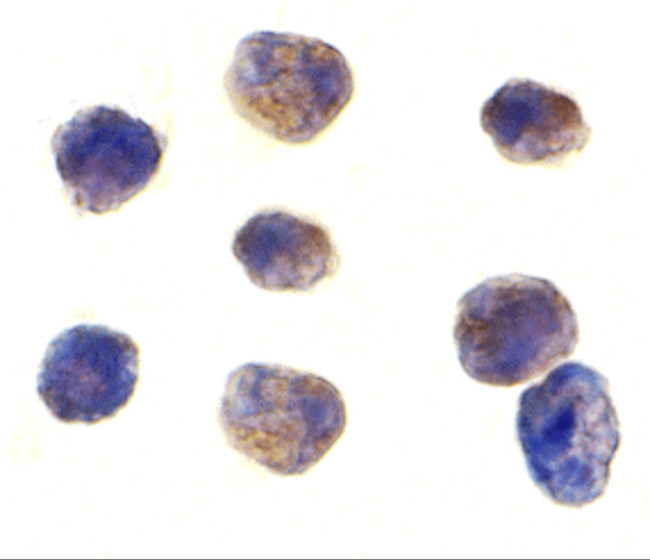 TAB1 Antibody in Immunocytochemistry (ICC/IF)