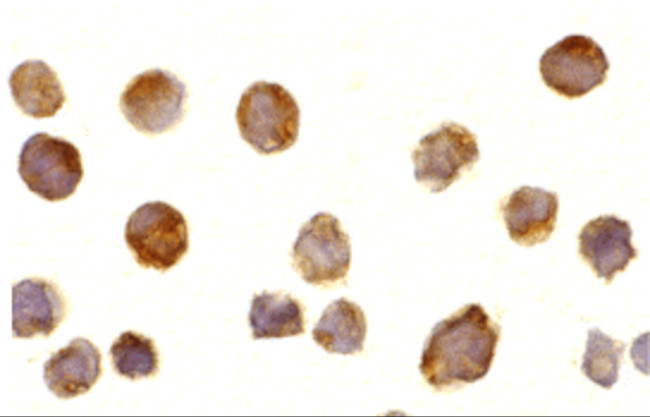 Btk Antibody in Immunocytochemistry (ICC/IF)