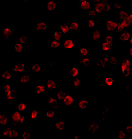 Btk Antibody in Immunocytochemistry (ICC/IF)