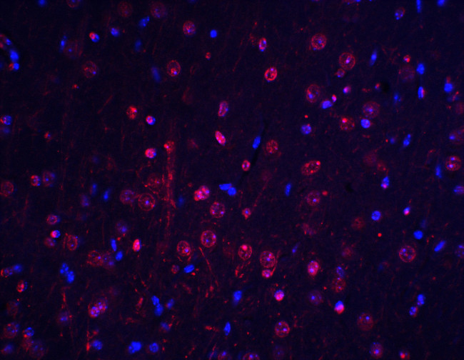 Btk Antibody in Immunohistochemistry (IHC)