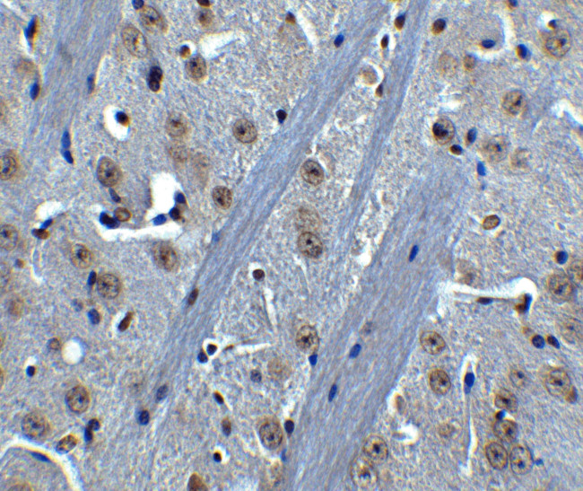 Btk Antibody in Immunohistochemistry (IHC)