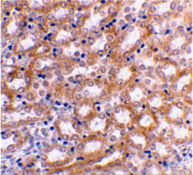 IRF3 Antibody in Immunohistochemistry (IHC)