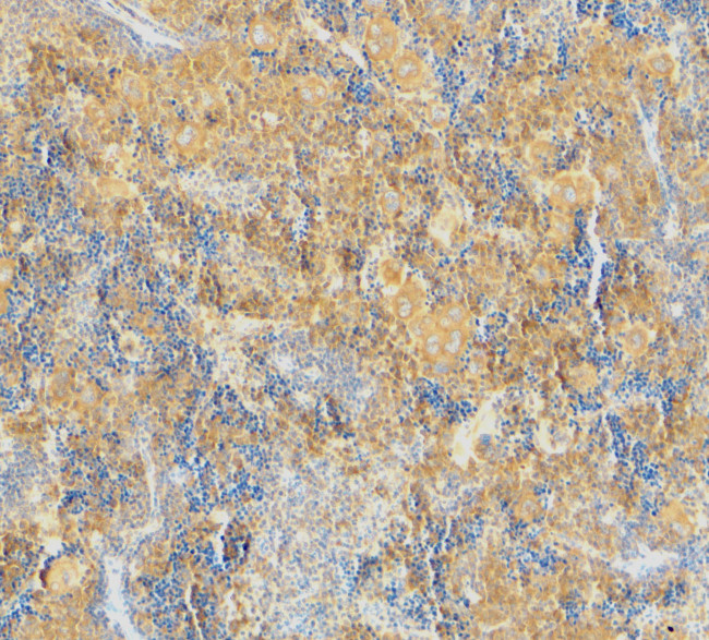 Caspase 4 Antibody in Immunohistochemistry (IHC)