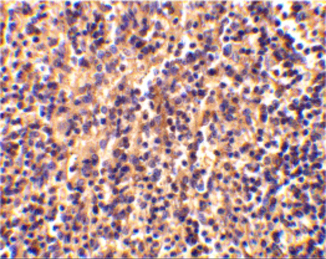 Caspase 4 Antibody in Immunohistochemistry (IHC)