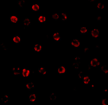 Caspase 1 Antibody in Immunocytochemistry (ICC/IF)