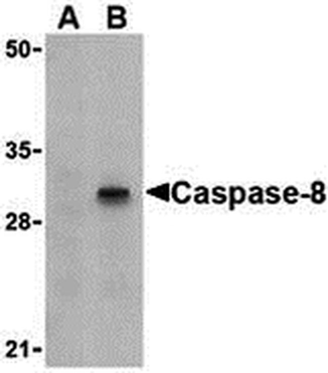 Caspase 8 Antibody in Western Blot (WB)