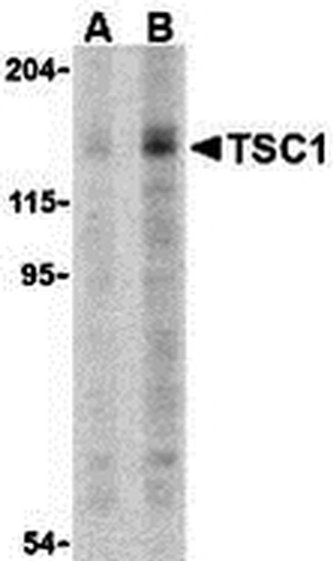 TSC1 Antibody in Western Blot (WB)