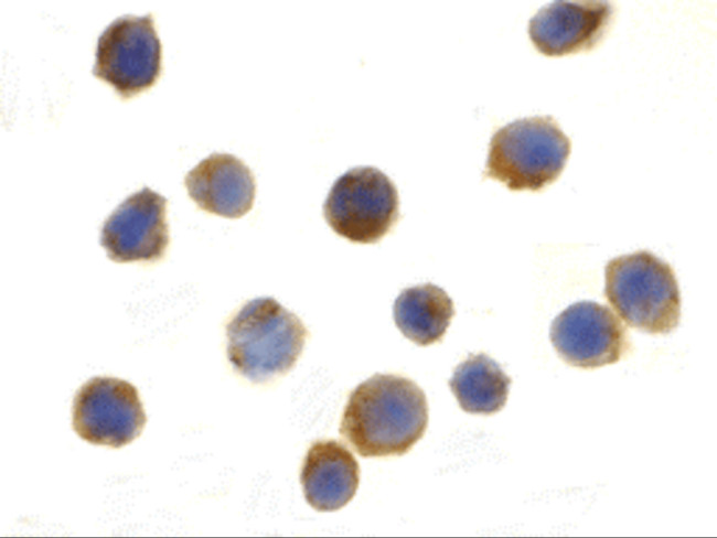 TSC1 Antibody in Immunocytochemistry (ICC/IF)