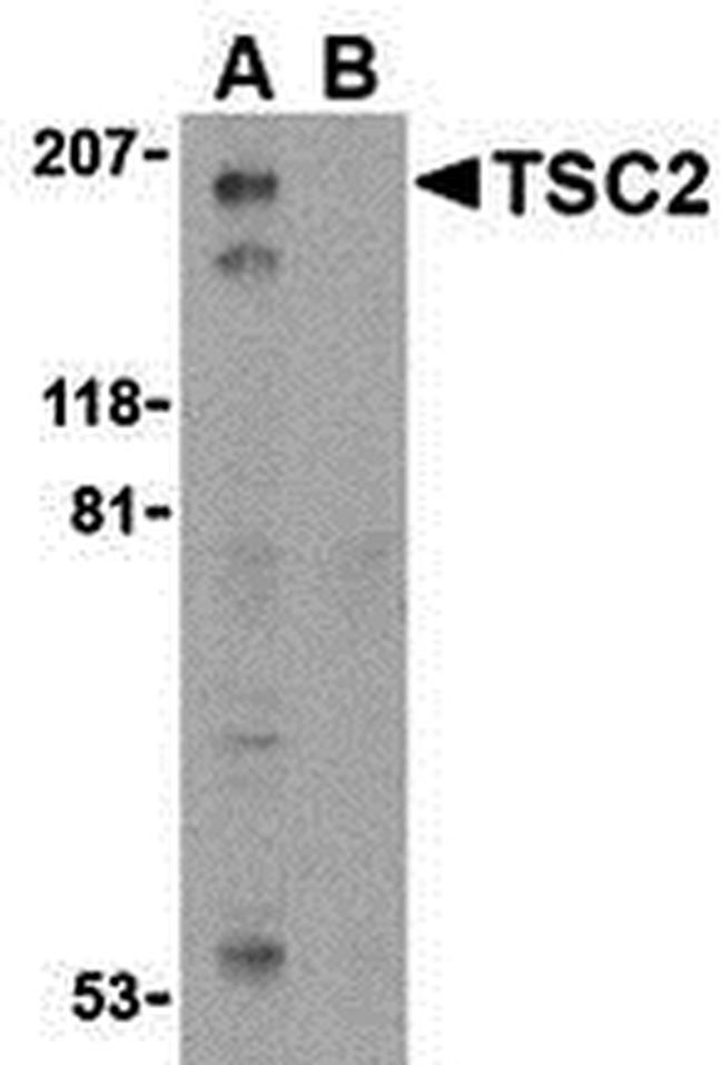 TSC2 Antibody in Western Blot (WB)