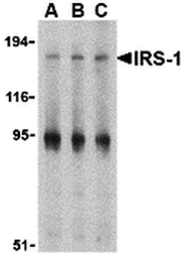 IRS1 Antibody in Western Blot (WB)