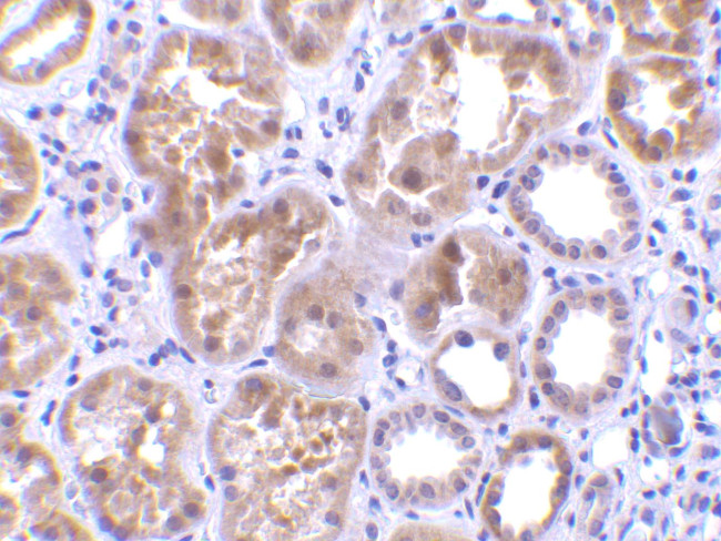 CTRP1 Antibody in Immunohistochemistry (IHC)