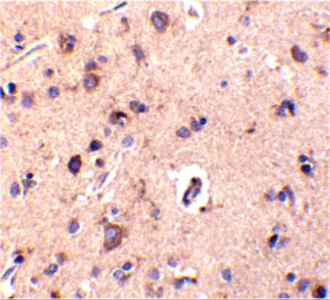 CTRP2 Antibody in Immunohistochemistry (IHC)