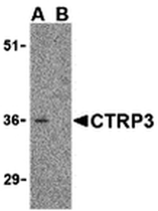 CTRP3 Antibody in Western Blot (WB)