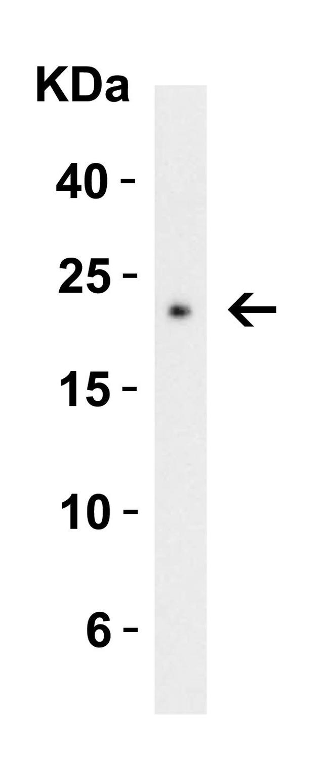 CTRP3 Antibody in Western Blot (WB)