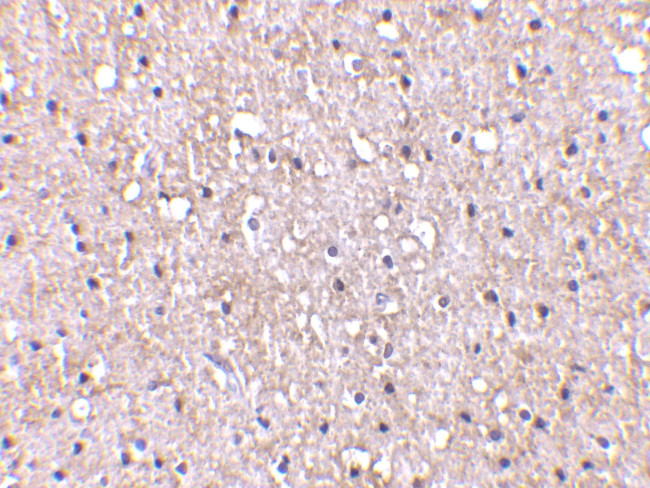 CTRP5 Antibody in Immunohistochemistry (IHC)