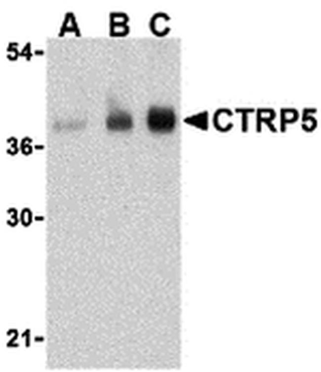 CTRP5 Antibody in Western Blot (WB)