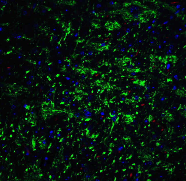 H-cadherin Antibody in Immunohistochemistry (IHC)