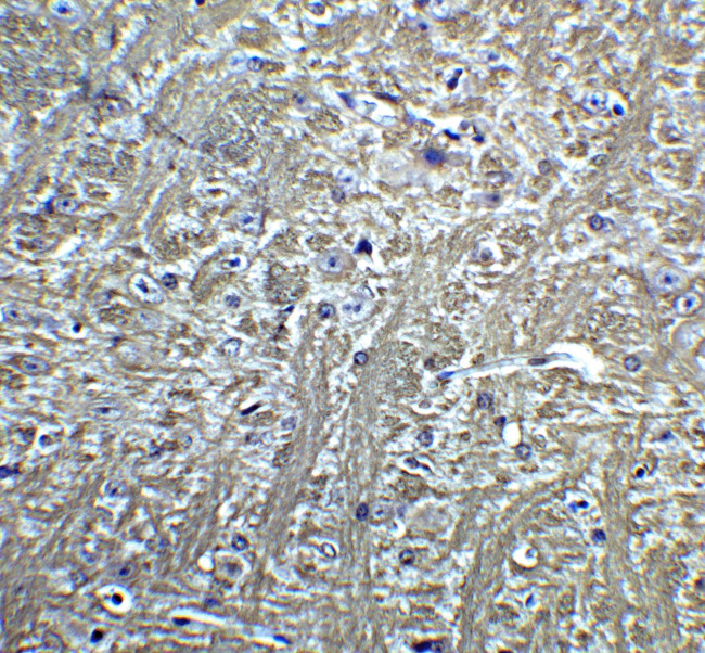 H-cadherin Antibody in Immunohistochemistry (IHC)