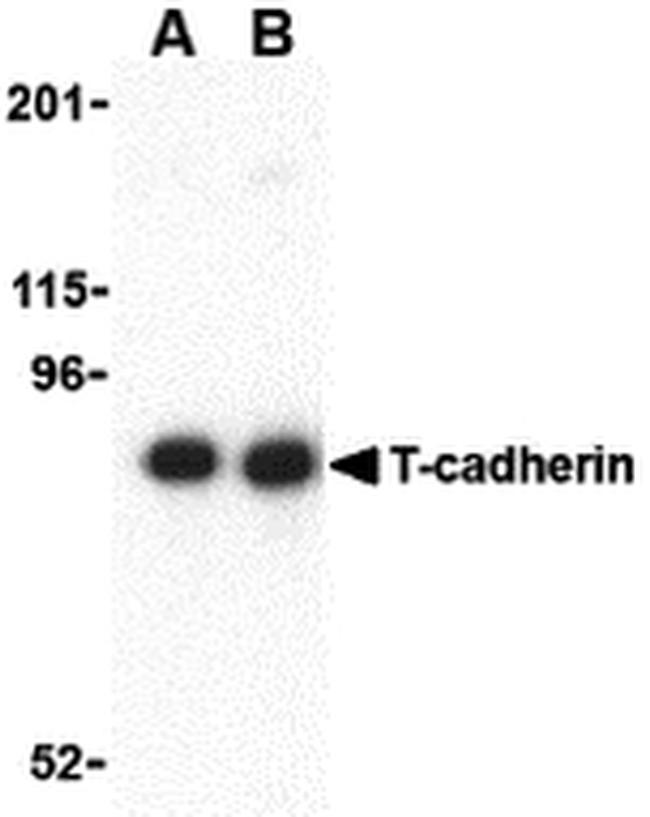 H-cadherin Antibody in Western Blot (WB)