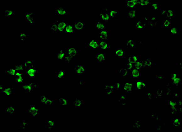 IRAK2 Antibody in Immunocytochemistry (ICC/IF)