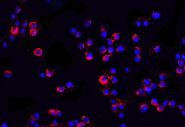 IRAK2 Antibody in Immunocytochemistry (ICC/IF)