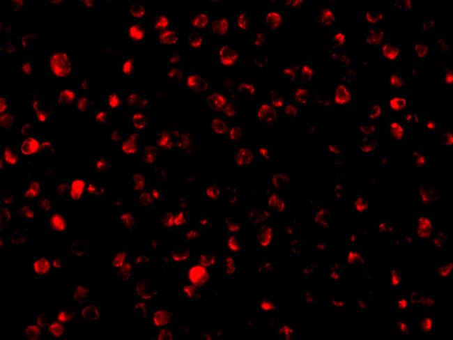 Bit1 Antibody in Immunocytochemistry (ICC/IF)