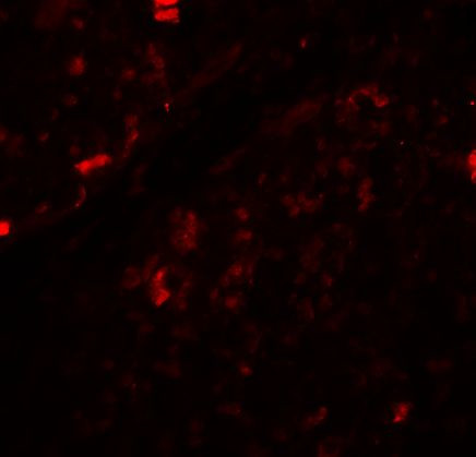 Beclin 1 Antibody in Immunohistochemistry (IHC)