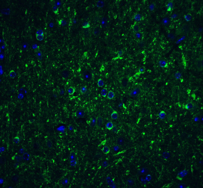 Beclin 1 Antibody in Immunohistochemistry (IHC)