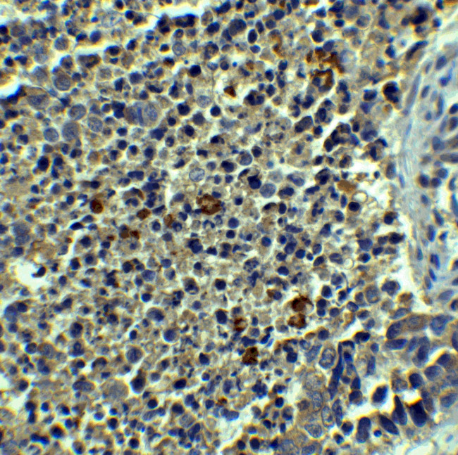 Beclin 1 Antibody in Immunohistochemistry (IHC)