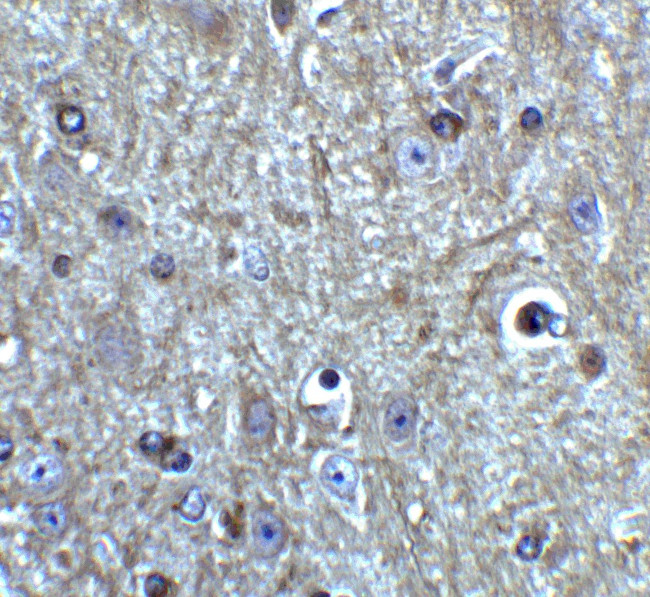 Beclin 1 Antibody in Immunohistochemistry (IHC)