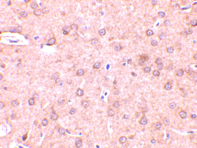 Beclin 1 Antibody in Immunohistochemistry (IHC)