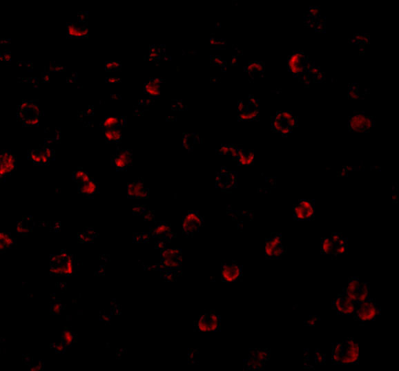 ATG7 Antibody in Immunocytochemistry (ICC/IF)