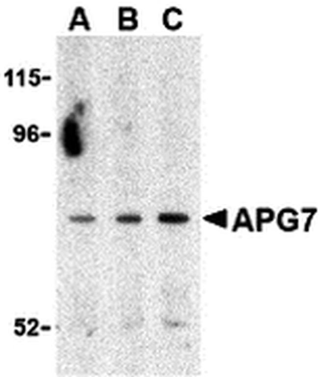 ATG7 Antibody in Western Blot (WB)