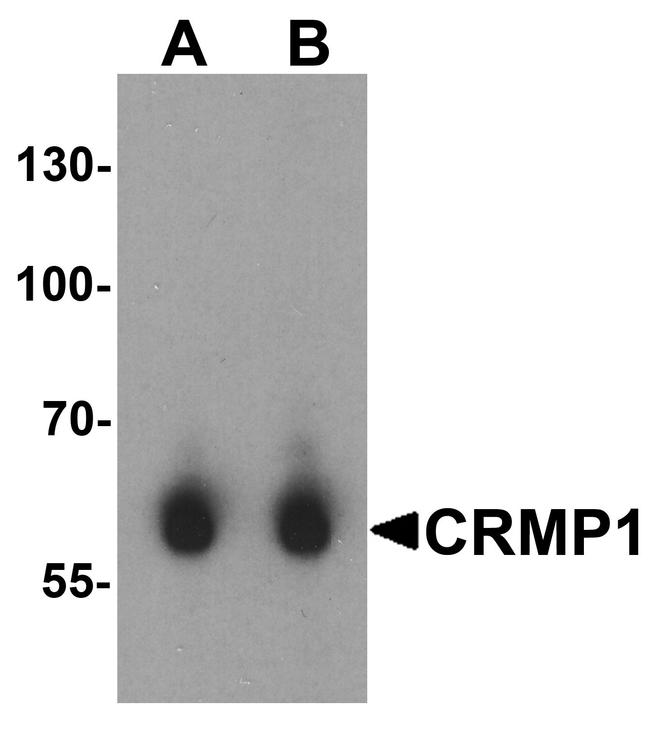 CRMP1 Antibody in Western Blot (WB)