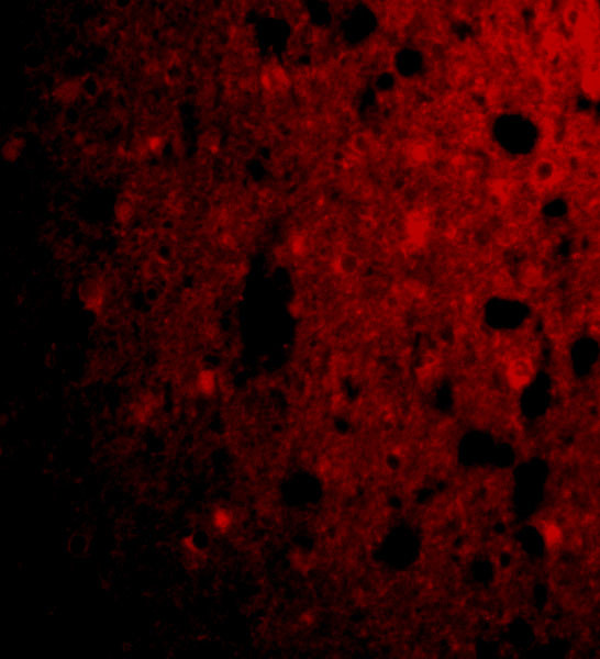 CRMP1 Antibody in Immunocytochemistry (ICC/IF)