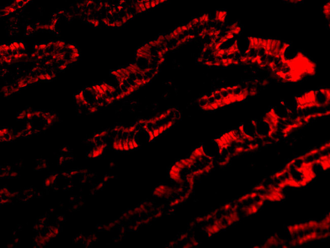 PIST Antibody in Immunocytochemistry (ICC/IF)