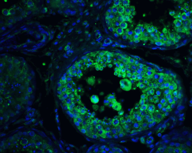 PIST Antibody in Immunohistochemistry (IHC)