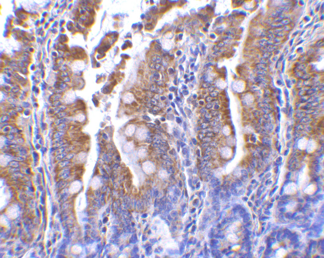 PIST Antibody in Immunohistochemistry (IHC)