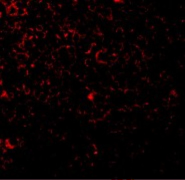 TLR1 Antibody in Immunohistochemistry (IHC)