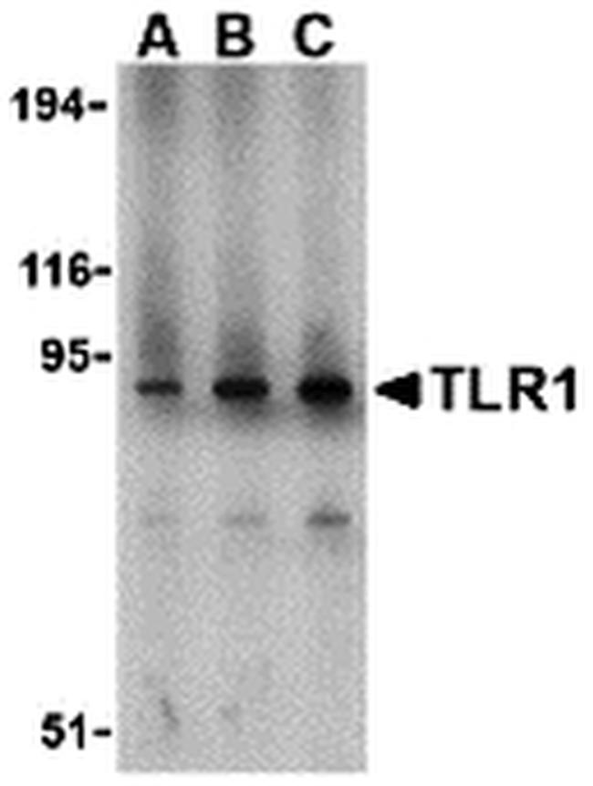 TLR1 Antibody in Western Blot (WB)