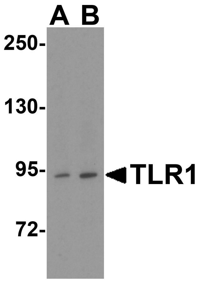 TLR1 Antibody in Western Blot (WB)