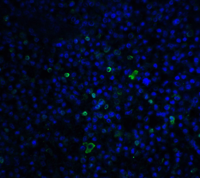 TLR3 Antibody in Immunohistochemistry (IHC)