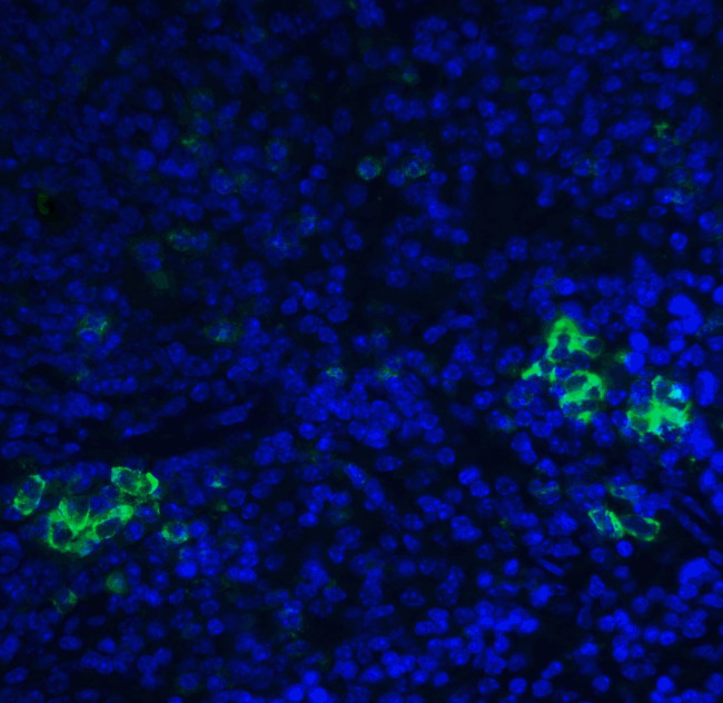 TLR3 Antibody in Immunohistochemistry (IHC)