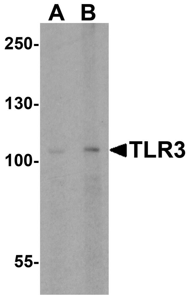 TLR3 Antibody in Western Blot (WB)