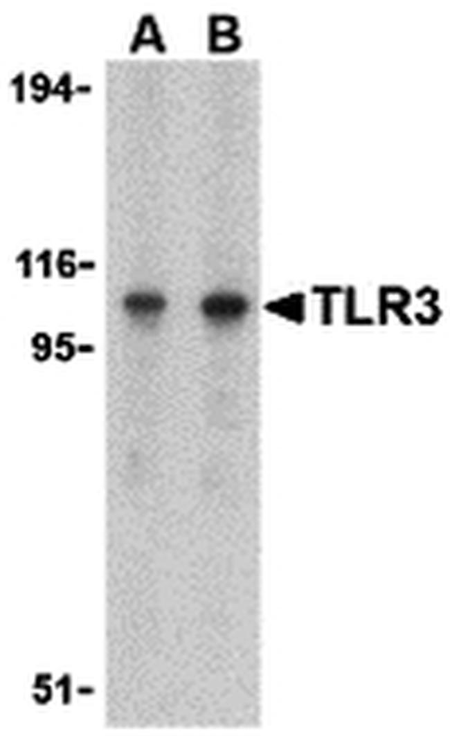 TLR3 Antibody in Western Blot (WB)