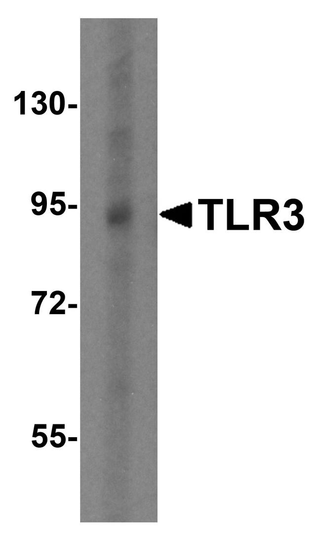 TLR3 Antibody in Western Blot (WB)